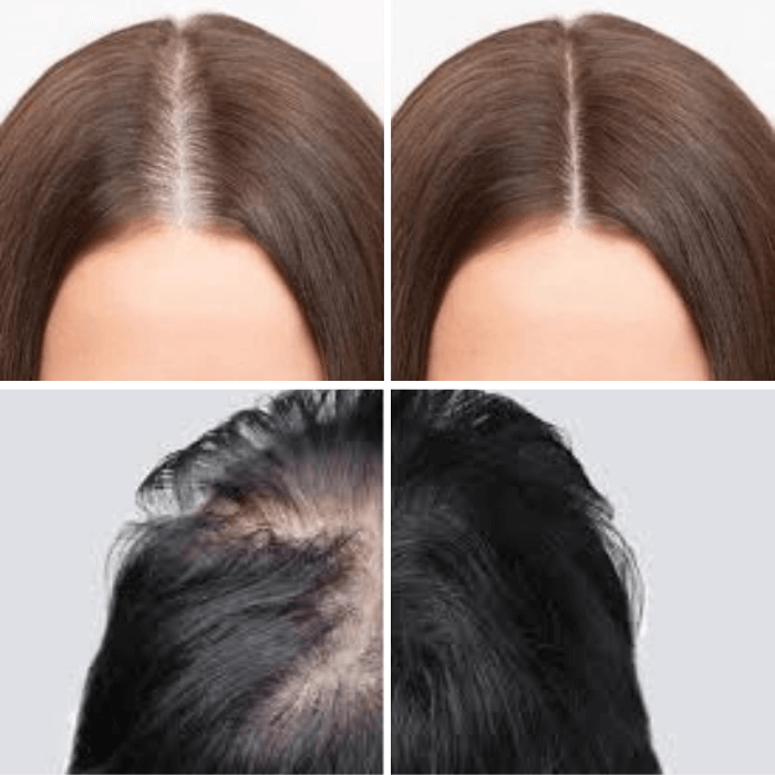 StemBoost Hair Cap